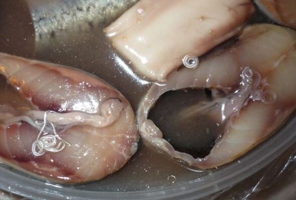 Infektionswege des Menschen durch Parasiten