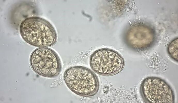 Parasiten unter der Lupe