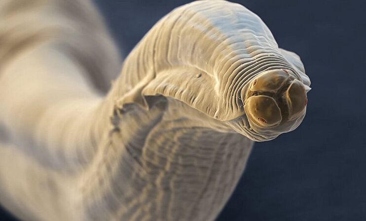 parasitärer Wurm aus dem menschlichen Körper